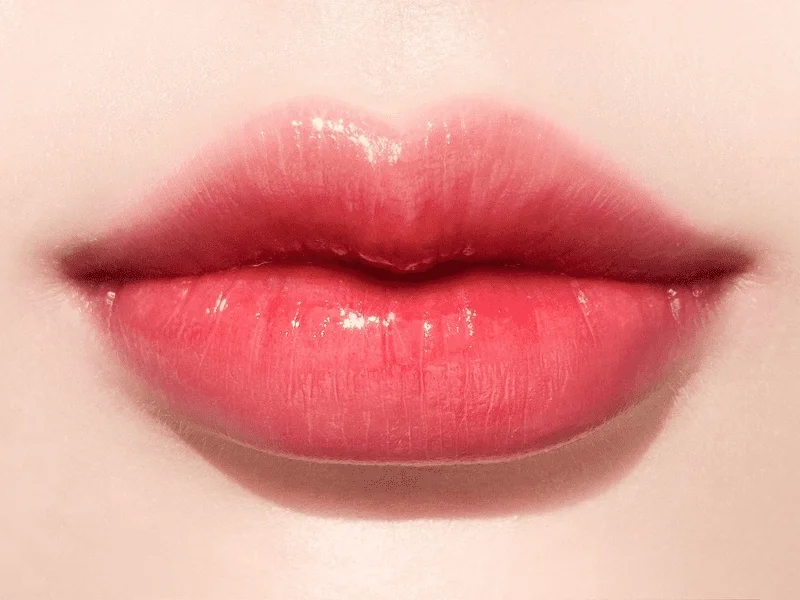 Tiêm filler môi giúp đôi môi căng mọng, quyến rũ