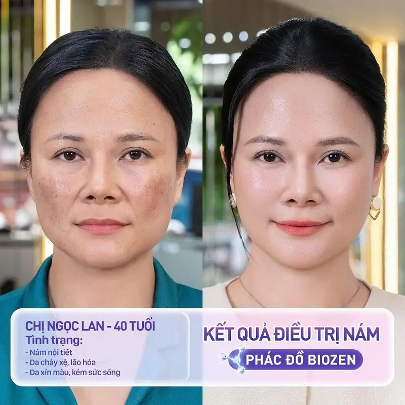 Khách hàng cải thiện làn da rõ rệt