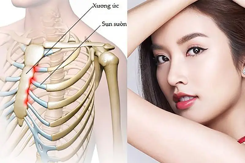 Nâng mũi sụn sườn là phương pháp tạo hình mũi an toàn, hiệu quả