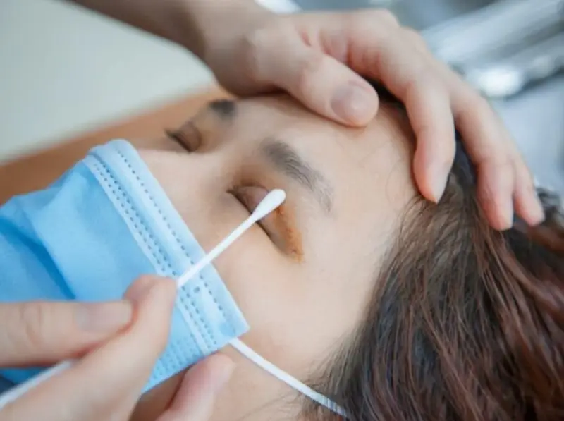 Làm sạch mí mắt trước khi bôi thuốc trị sẹo