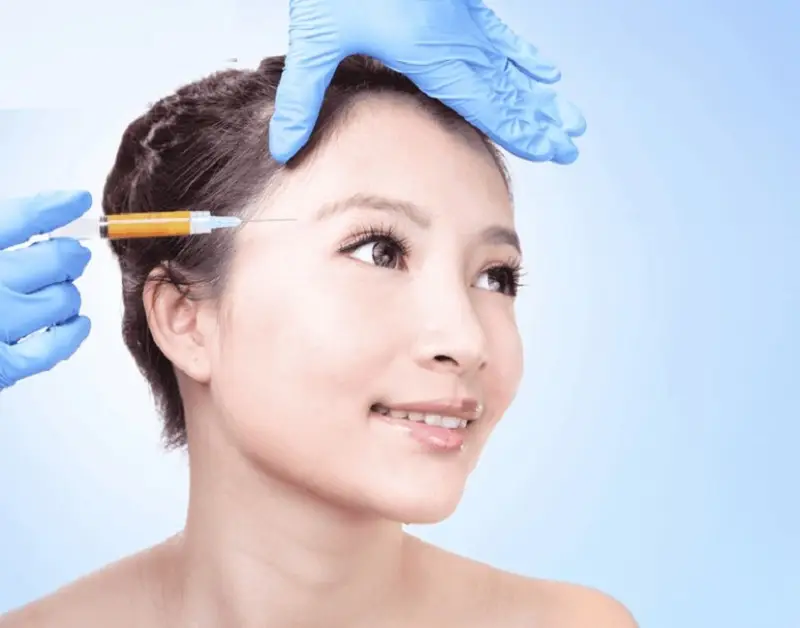 Cấy mỡ giúp gương mặt đầy đặn tươi trẻ, duy trì hiệu quả được từ 3 - 5 năm