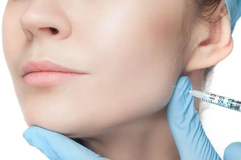 Tiêm filler má
