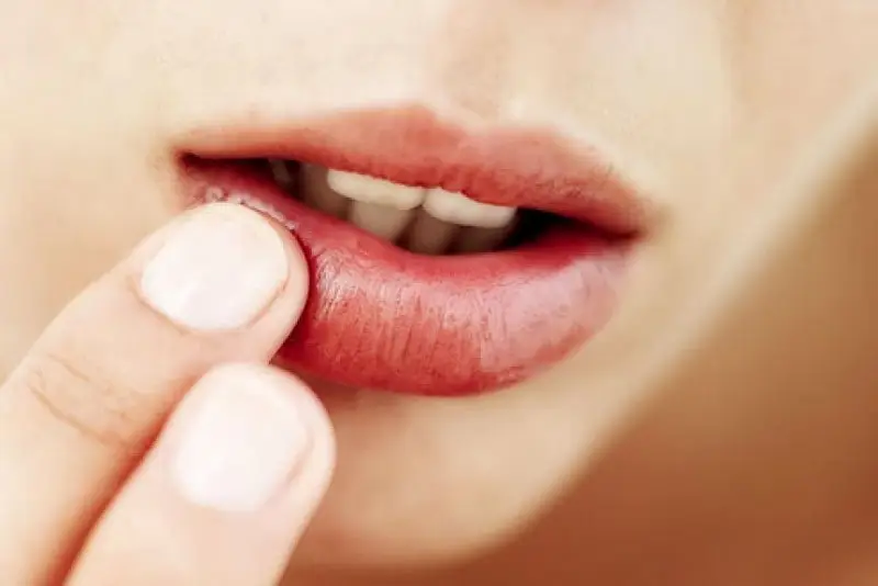 Tránh sờ nắn, xoa bóp đến vùng môi