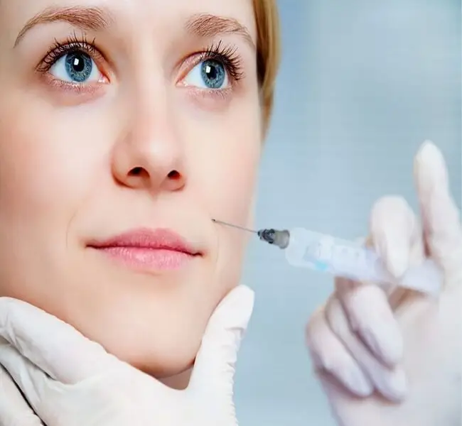 Tiêm filler rãnh cười cần 24-48 giờ sẽ ổn định