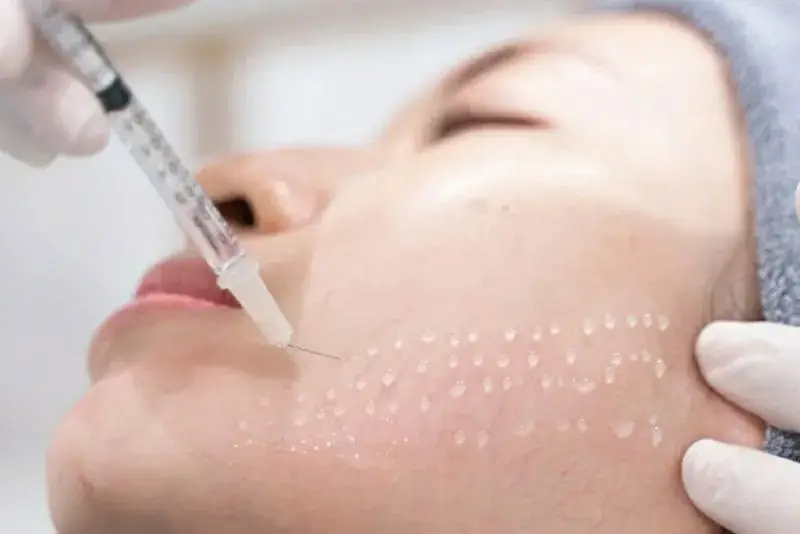 Tiêm meso đẹp ngay sau 18 giờ tiêm