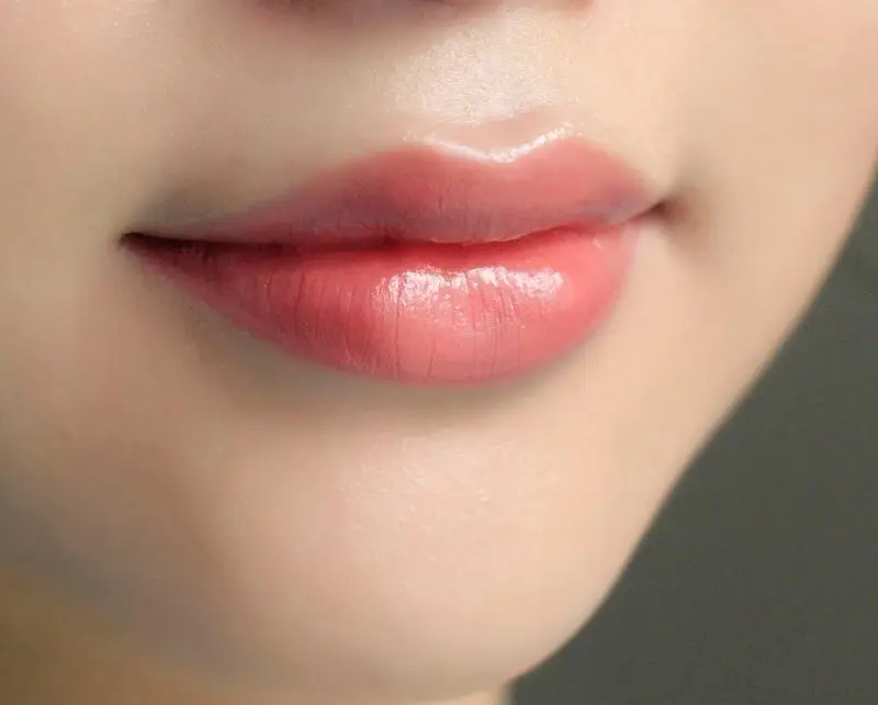 Đôi môi sau khi hết tình trạng sưng tấy