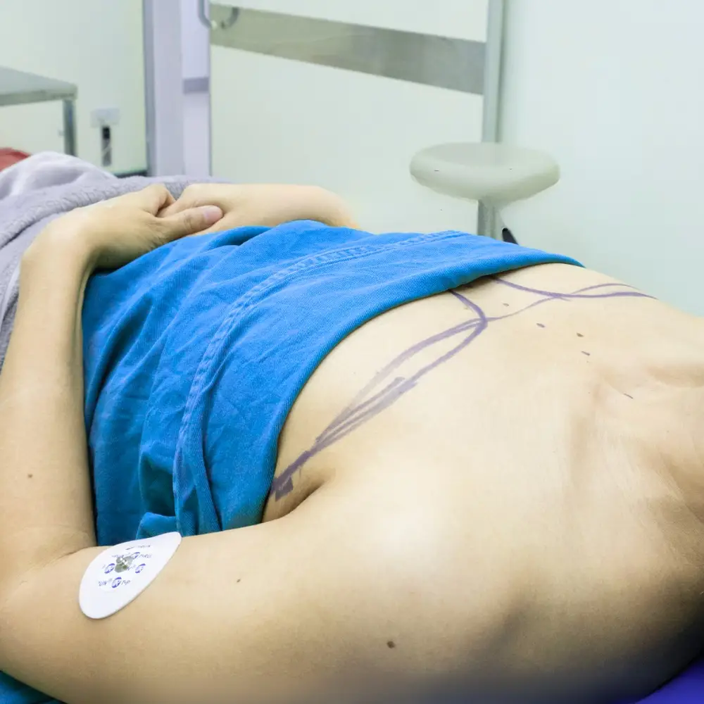 Con gái ngực nép do nhiều nguyên nhân 