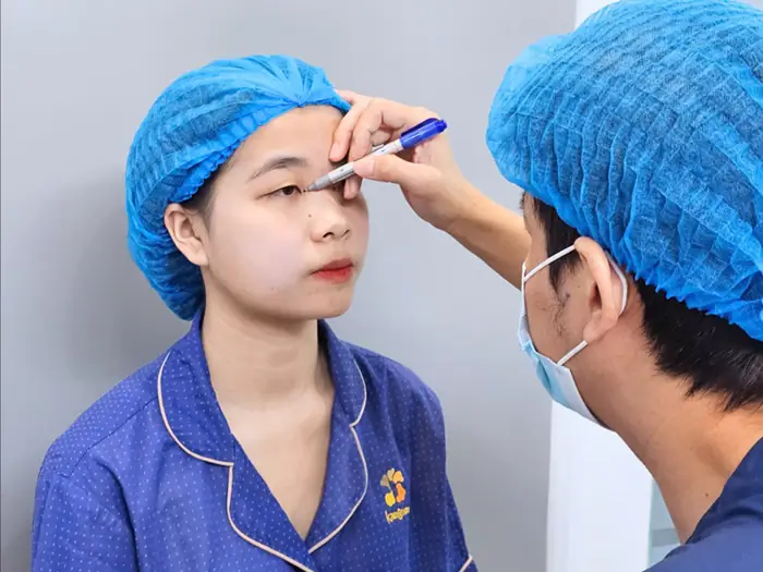 Bác sĩ đo đạc, để tạo nếp mí mới giúp quá trình cắt mí diễn ra thuận lợi