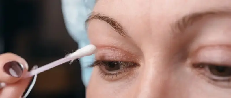 Sử dụng nước muối sinh lý để vệ sinh mí mắt trước khi bôi kem