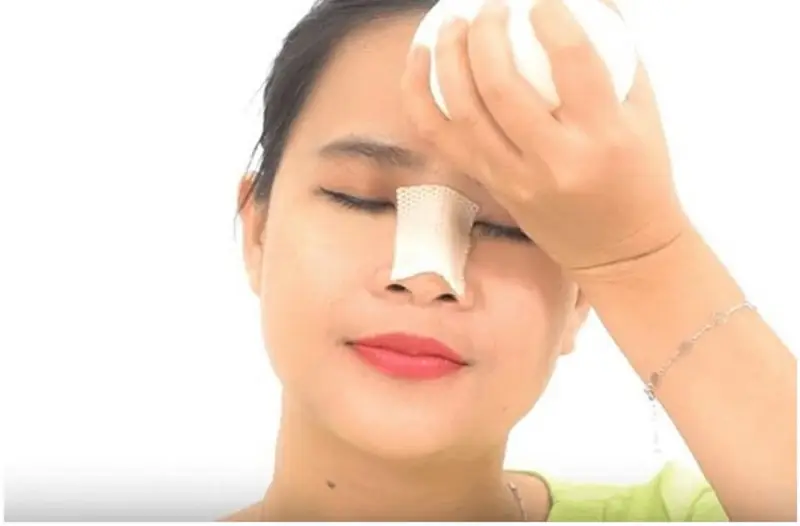 Chườm lạnh xung quanh vùng mũi để giảm thiểu tình trạng căng tức