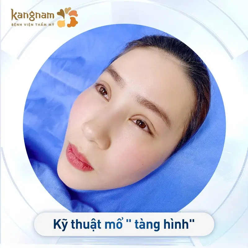 Sử dụng dao mổ Plasma Plus tạo đường mổ siêu mảnh, vết mổ "tàng hình