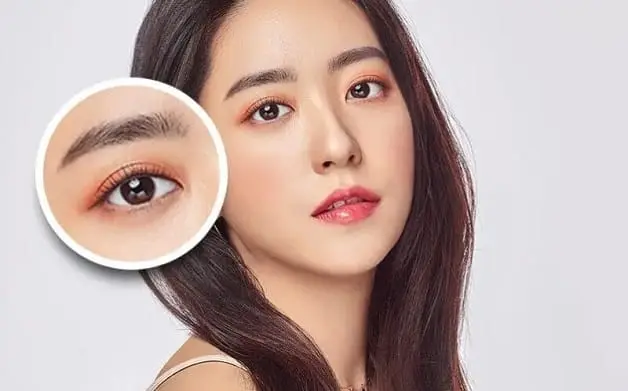 Cắt mí Eyelid có thời gian phục hồi nhanh từ 7 - 10 ngày