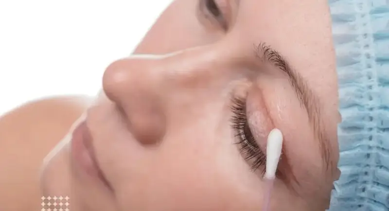 Khách hàng nên sử dụng nước muối, tăm bông hoặc bông gạc để làm sạch vết thương