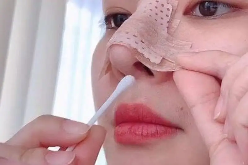 Vệ sinh sai cách khiến mũi chảy dịch