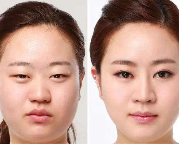 Nhấn mí mắt giúp khuôn mặt hài hòa, tươi trẻ hơn