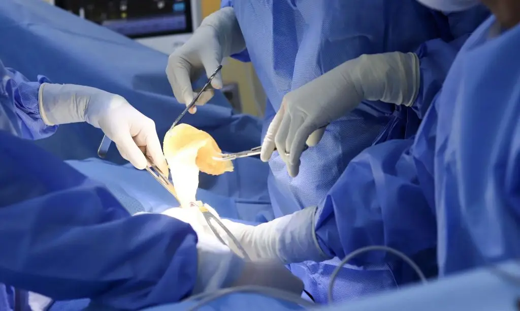 Tháo túi ngực cần được thực hiện bởi các bác sĩ chuyên môn