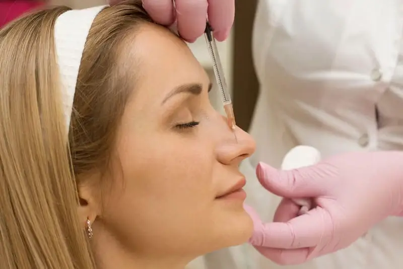 Tiêm filler mũi có mức giá phụ thuộc vào từng loại filler