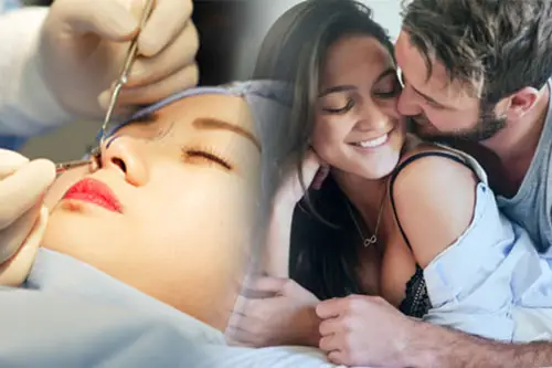 Sau nâng mũi nên kiêng quan hệ một thời gian