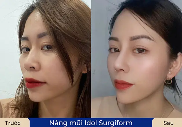 Chăm sóc đúng cách giúp vết thương vùng mũi nhanh lành, không sẹo