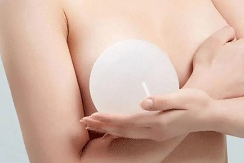 Bề mặt túi ngực nano chip có tới 8000 tiếp điểm/cm