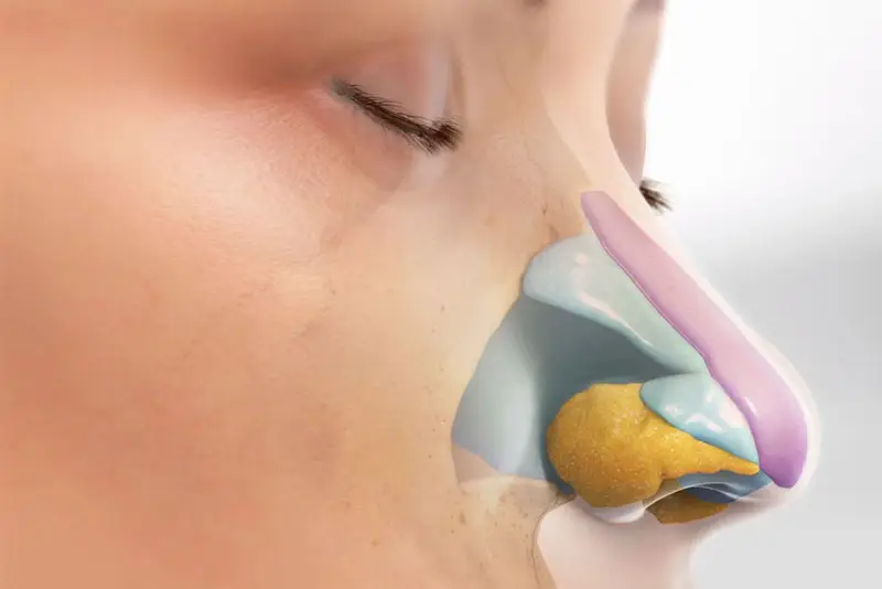 Sụn Superform dễ dàng tích hợp với các mô mềm xung quanh