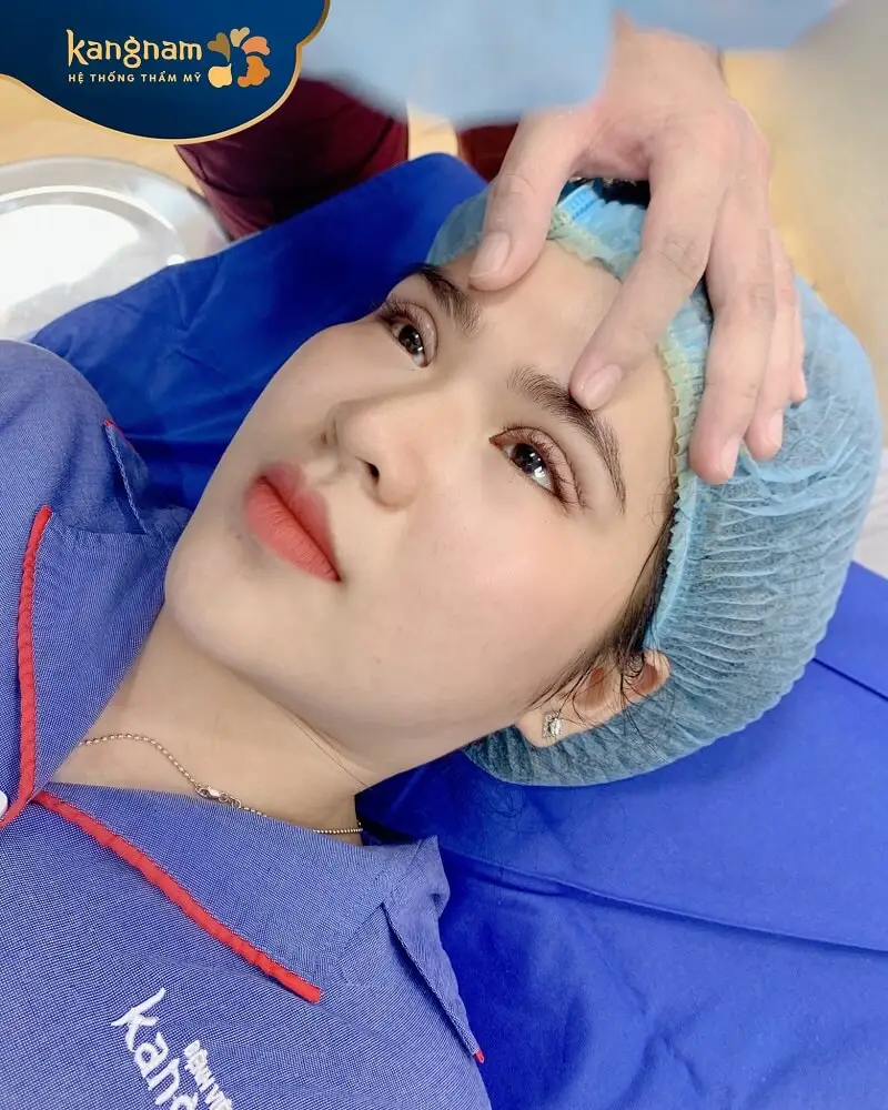 Thời gian phục hồi sau khi cắt mí tại Kangnam Cần Thơ từ 5 - 10 ngày