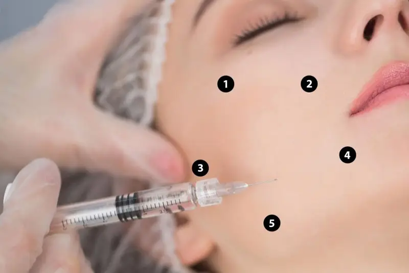 Tiêm BPAP Profhilo là phương pháp hiện đại giúp da căng bóng