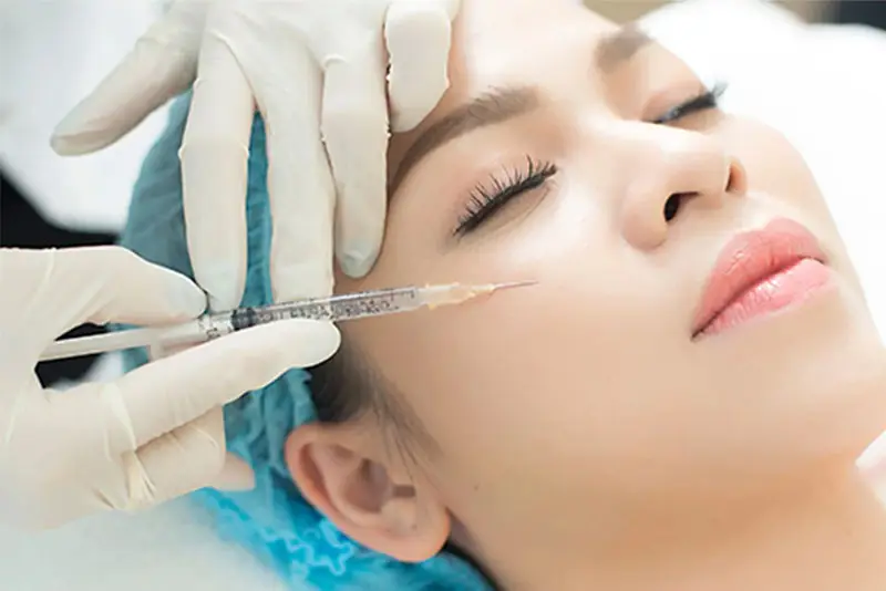 Tiêm filler má giúp tạo độ đầy đặn cho gương mặt trẻ trung hơn