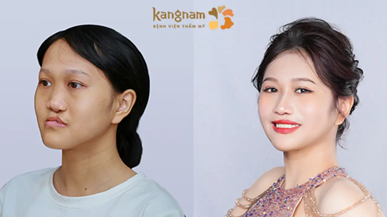 Thí sinh Hành trình Lột xác mùa 6 Xuân Mai