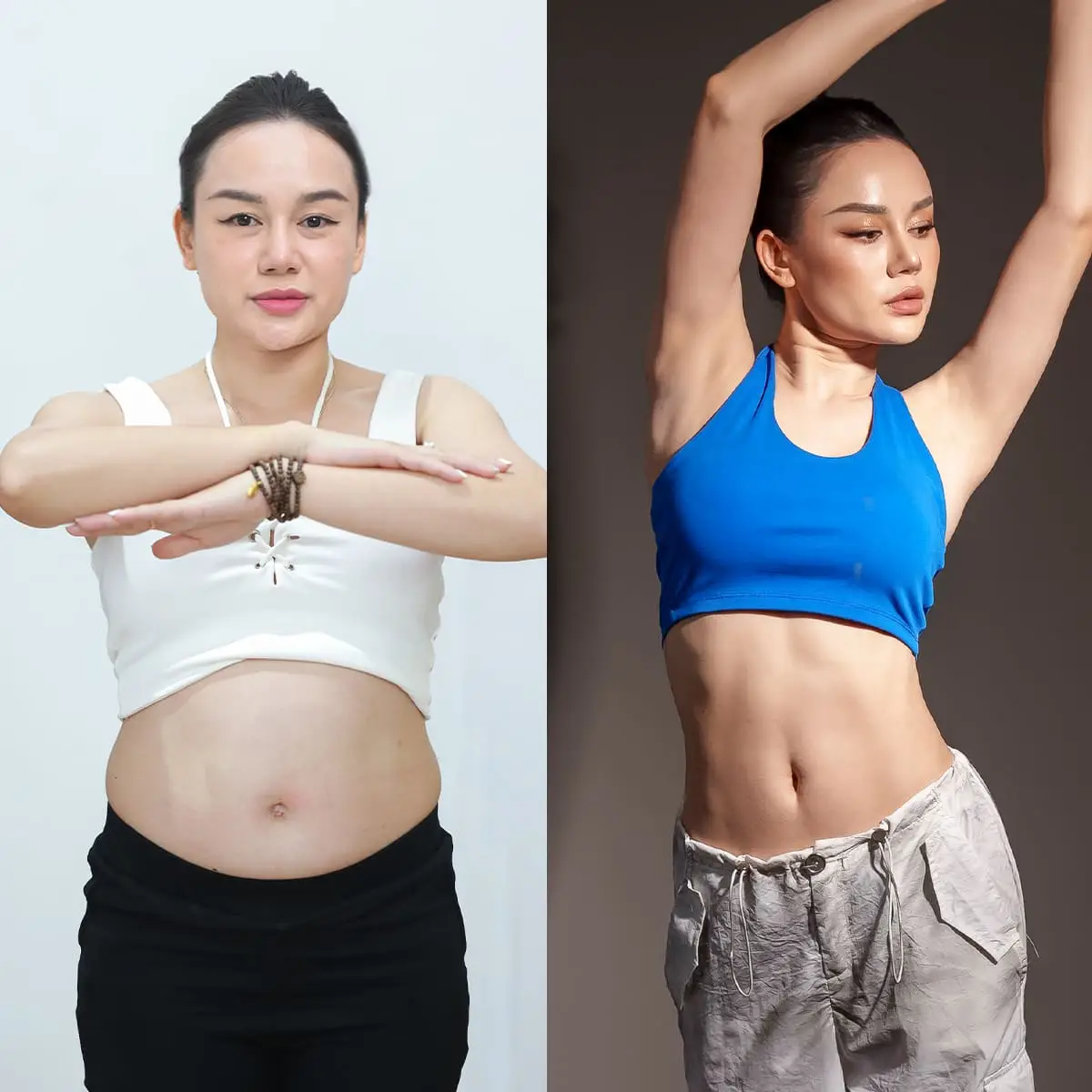 Vóc dáng săn chắc, thọn gọn sau khi hút mỡ bụng 