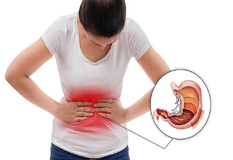 Những người bị đau dạ dày nên tham khảo ý kiến của bác sĩ chuyên khoa