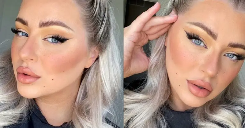 Căng chỉ mắt cáo tạo đôi mắt sắc sảo, quyến rũ