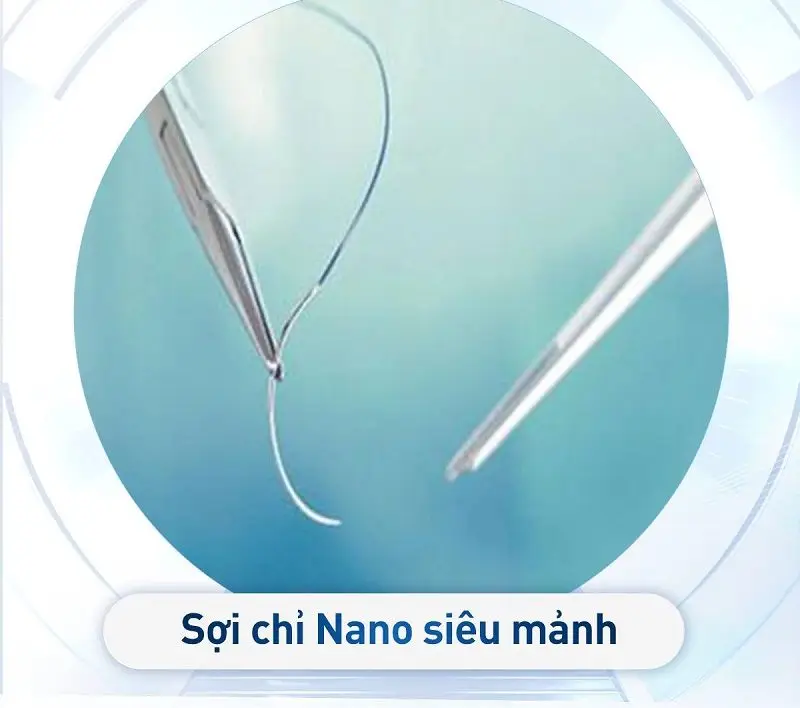 Nếu sử dụng chỉ khâu chất lượng cao sẽ giúp giảm thiểu nguy cơ để lại sẹo 
