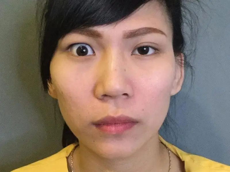 Kỹ thuật thực hiện không chính xác khiến mắt bị lệch