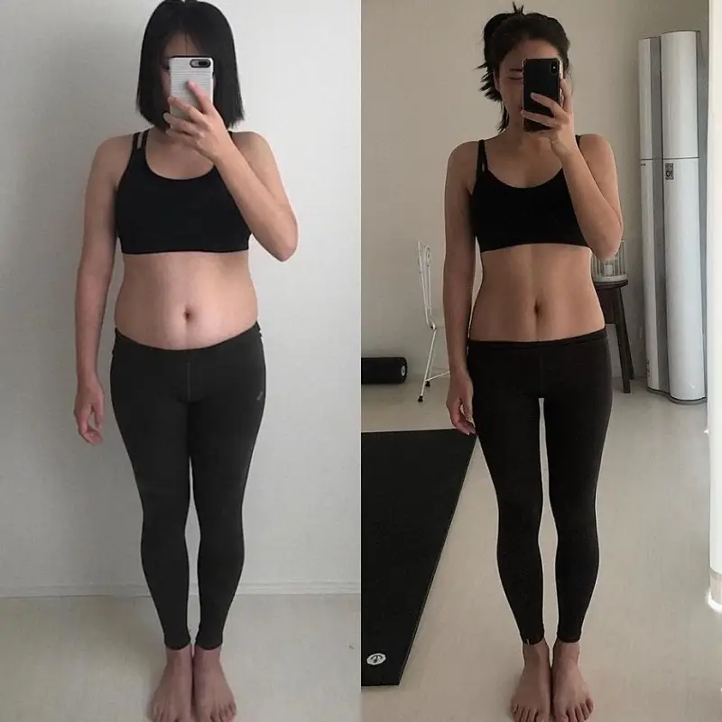 Thực hiện giảm mỡ tại địa chỉ thẩm mỹ uy tín giúp khách hàng sỡ hữu vóc dáng thon gọn