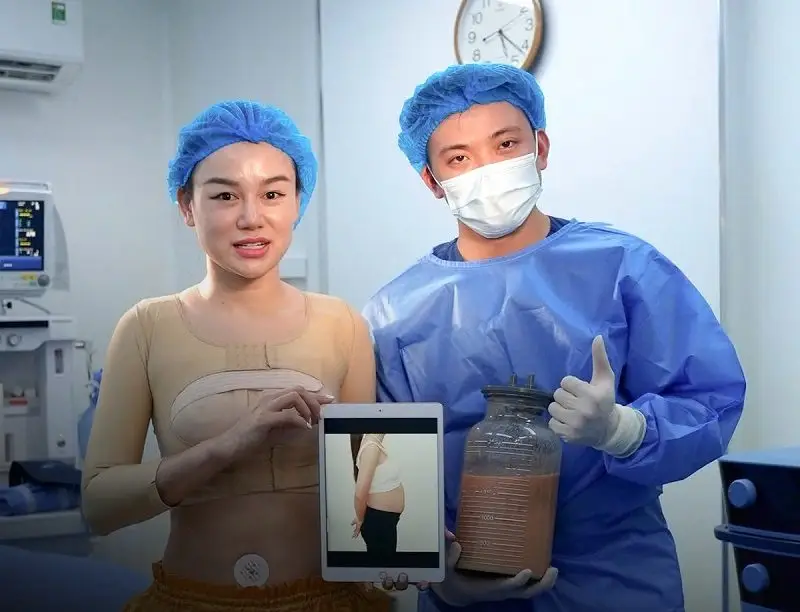 Khách hàng được thực hiện hút mỡ với bác sĩ chuyên khoa giỏi chuyên môn