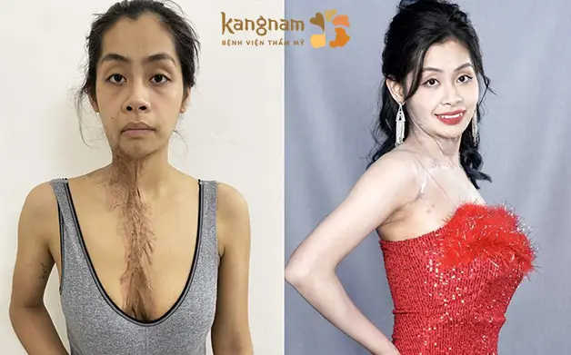 Thí sinh được tài trợ toàn bộ chi phí phẫu thuật