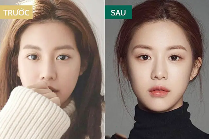 Chi phí độn thái dương khác nhau tùy vật liệu độn, cơ sở thực hiện