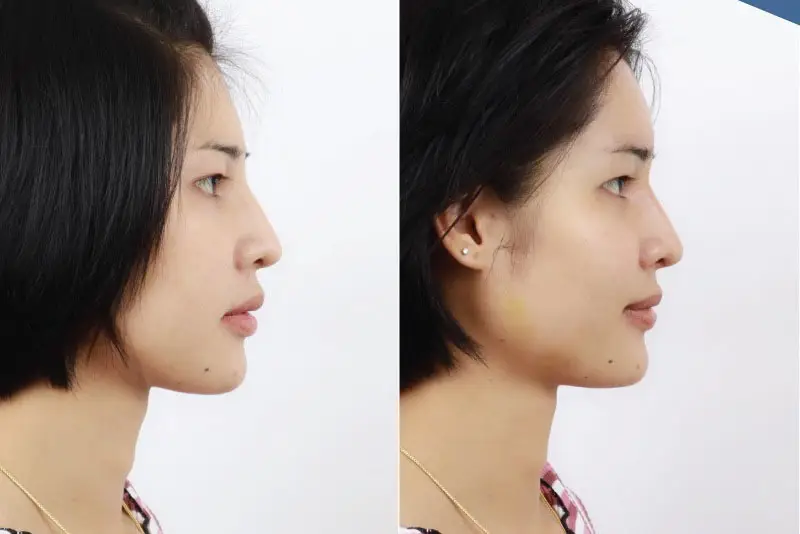 Lựa chọn cơ sở thẩm mỹ uy tín để có kết quả thẩm mỹ ưng ý