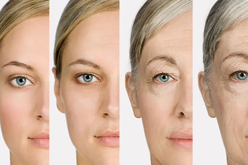 Hình ảnh nâng mũi khi về già, lão hóa khiến mũi không duy trì hình dáng ban đầu