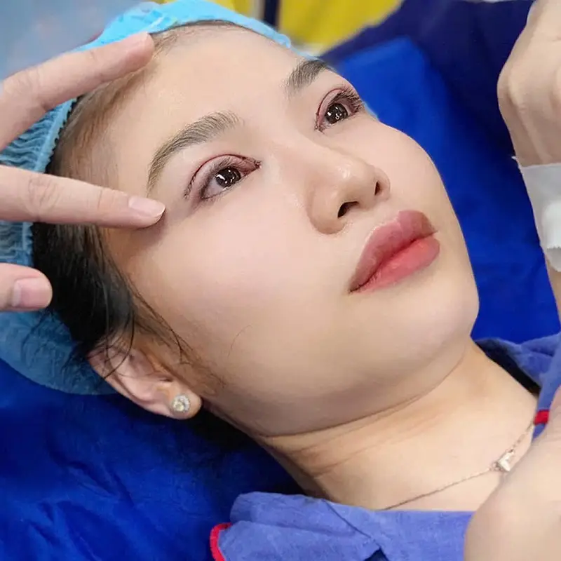 Tìm hiểu kinh nghiệm cắt mí giúp bạn đạt được hiệu quả thẩm mỹ tốt nhất