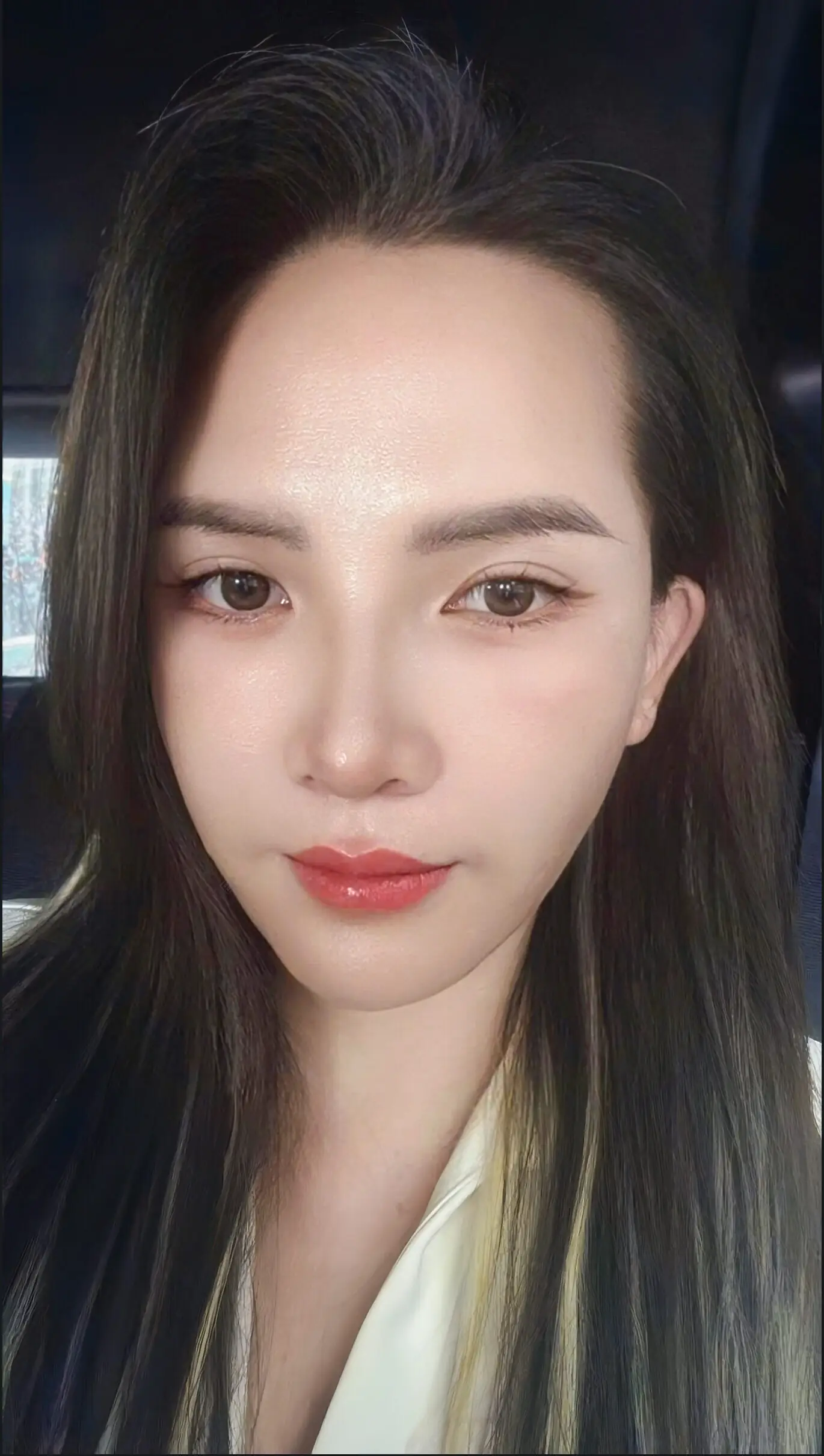 Sau cắt mí dưới, nâng cung mày và cấy mỡ mặt khuôn mặt của chị Vân đã tươi trẻ, rạng ngời hơn