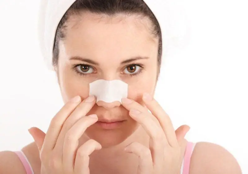 Phù nề cứng sau nâng mũi là biểu hiện thường gặp, cần lưu ý chăm sóc kỹ