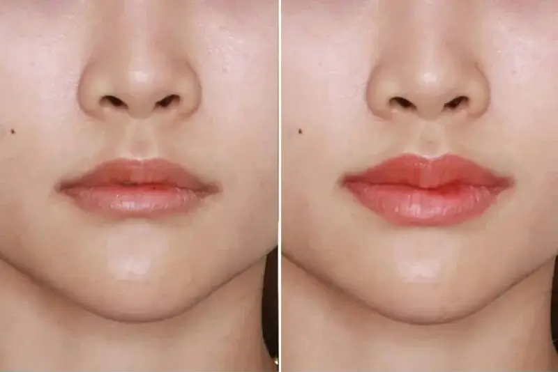 Đôi môi căng mọng, có độ cong nhẹ ở viền trên, tạo hiệu ứng môi trái tim đầy thu hút.