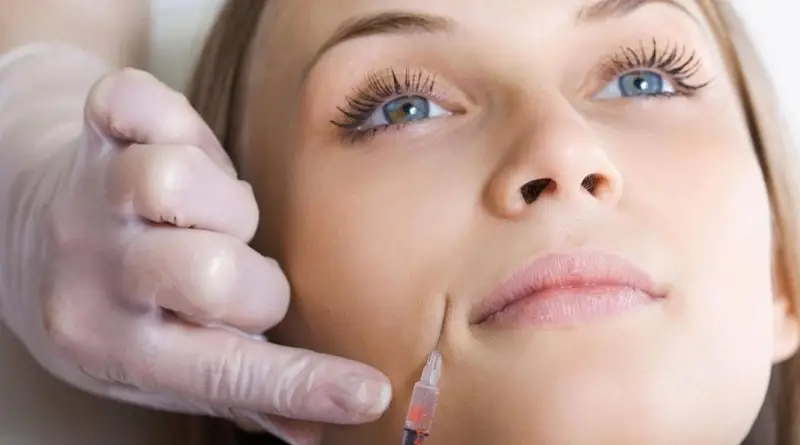 Bác sĩ tiêm quá nhiều filler có thể gây tràn chất làm đầy