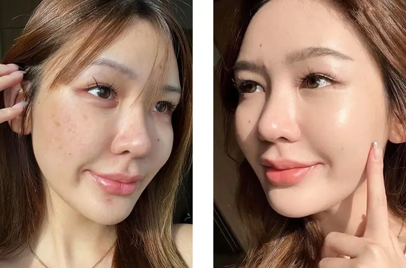 Khách hàng sở hữu gương mặt tươi sáng, căng bóng