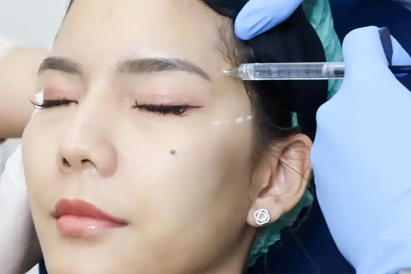 Nên tiêm tan filler tại cơ sở thẩm mỹ uy tín
