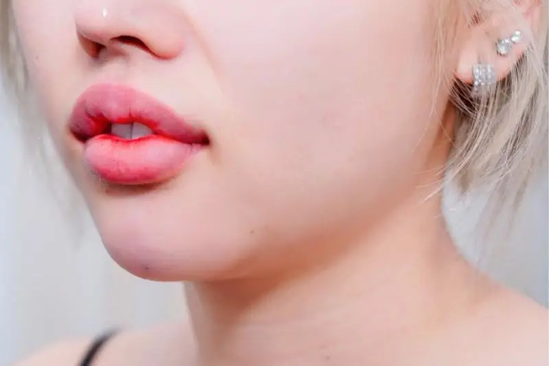 Lượng filler cũ còn nhiều cần cần sử dụng nhiều enzyme hơn