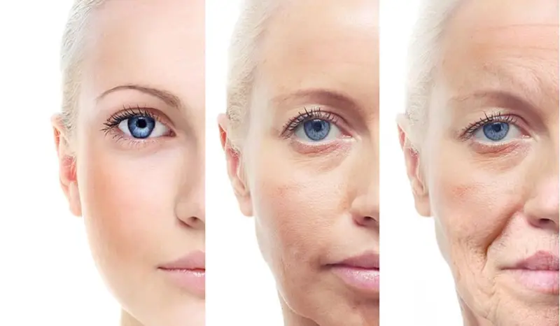 Làn da bắt đầu lão hóa, xuất hiện nếp nhăn từ 25 tuổi