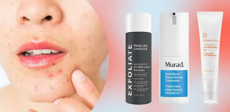 Lựa chọn sản phẩm trị mụn đặc trị sẽ giúp loại bỏ vi khuẩn gây mụn